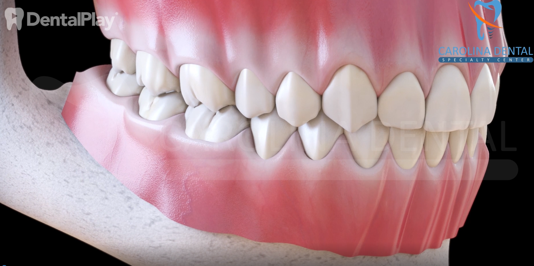 Experts from the Carolina Dental Specialty Center provide tips during Gum Care Awareness Month