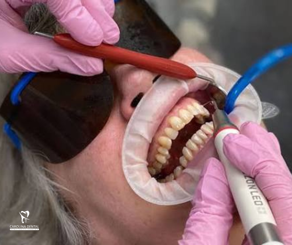 Carolina Dental Specialty Center Brings Guided Biofilm Therapy to Jacksonville